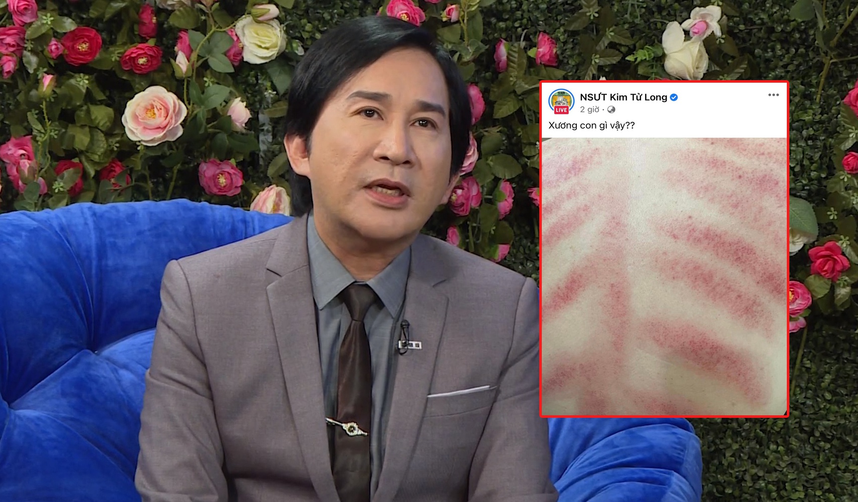 Khan Gia Lo Lang Cho Tinh Trang Suc Khoe Cua Nsut Kim Tu Long A86 6349807 1