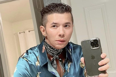 Ca sĩ Kasim Hoàng Vũ xuất hiện với mặt ‘biến dạng’