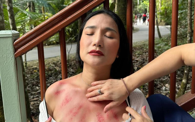 NSƯT Cát Tường gục ngã bên đường, thông báo gặp biến sức khỏe ở nước ngoài